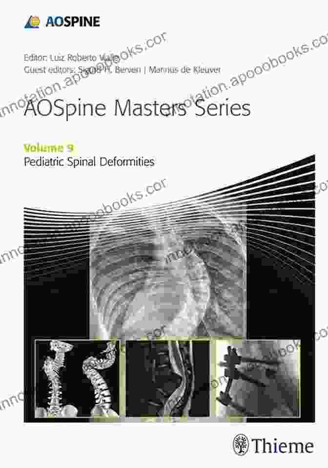 Aospine Masters Volume Pediatric Spinal Deformities Book Cover AOSpine Masters Volume 9: Pediatric Spinal Deformities (AOSpine Masters 9)