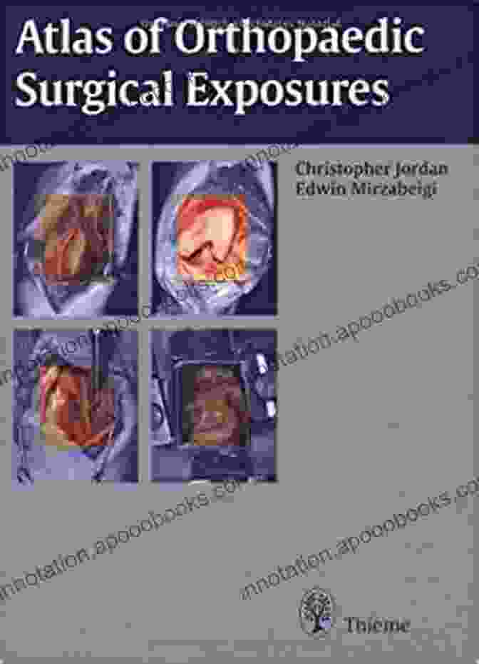 Atlas Of Orthopaedic Surgical Exposures Book Cover Atlas Of Orthopaedic Surgical Exposures