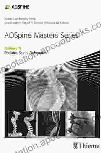 AOSpine Masters Volume 9: Pediatric Spinal Deformities (AOSpine Masters 9)