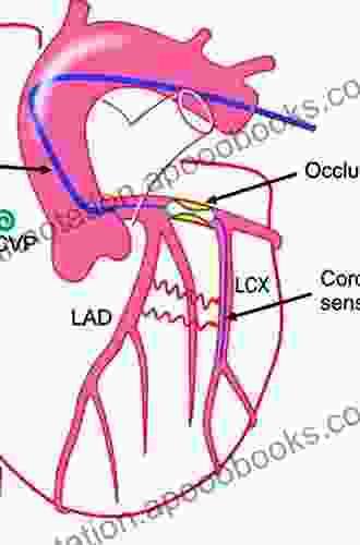 Collateral Circulation of the Heart