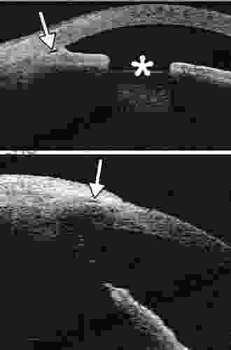 Glaucoma Imaging Hector Gonzalo