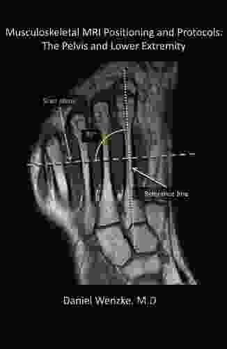 Musculoskeletal MRI Positioning and Protocols: The Pelvis and Lower Extremity